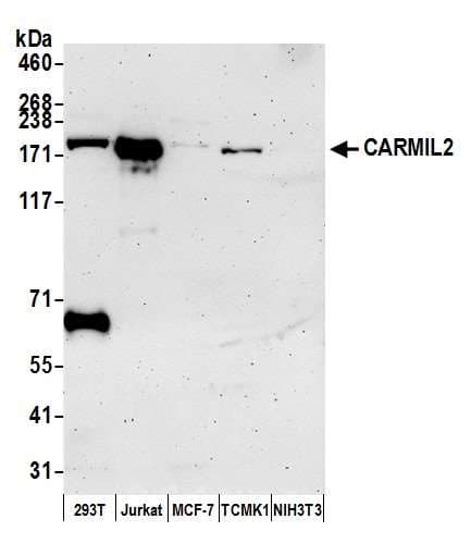 Polyclonal Rabbit anti-Human RLTPR Antibody (aa1385-1435, WB)