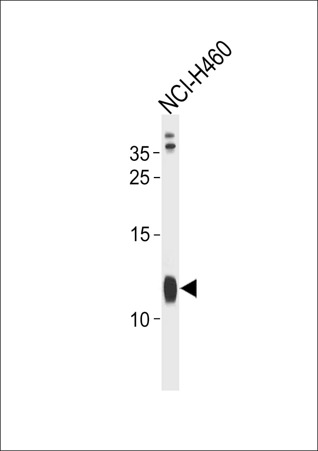Polyclonal Rabbit anti-Human RPS21 / Ribosomal Protein S21 Antibody (aa44-71, WB)