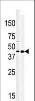 Polyclonal Rabbit anti-Human MOS Antibody (aa1-30, IHC, WB)