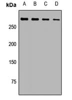 SPTA1 / Alpha Spectrin Antibody