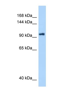 DHX16 / DBP2 Antibody (aa171-220)