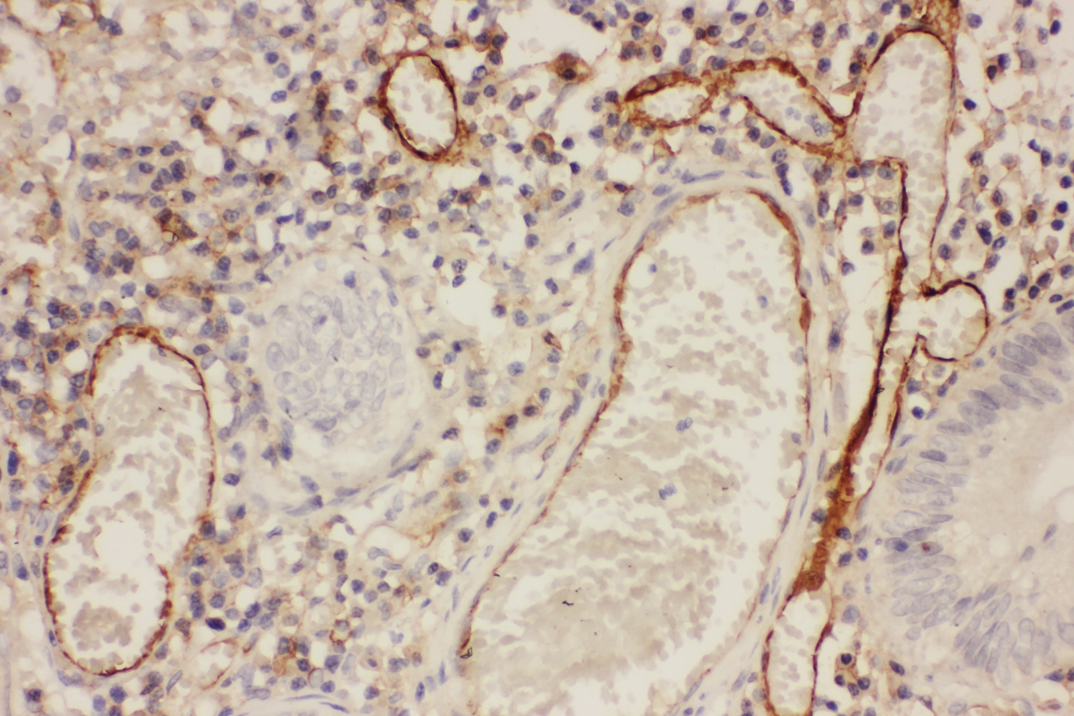 ICAM-1 / CD54 Antibody (aa214-532)