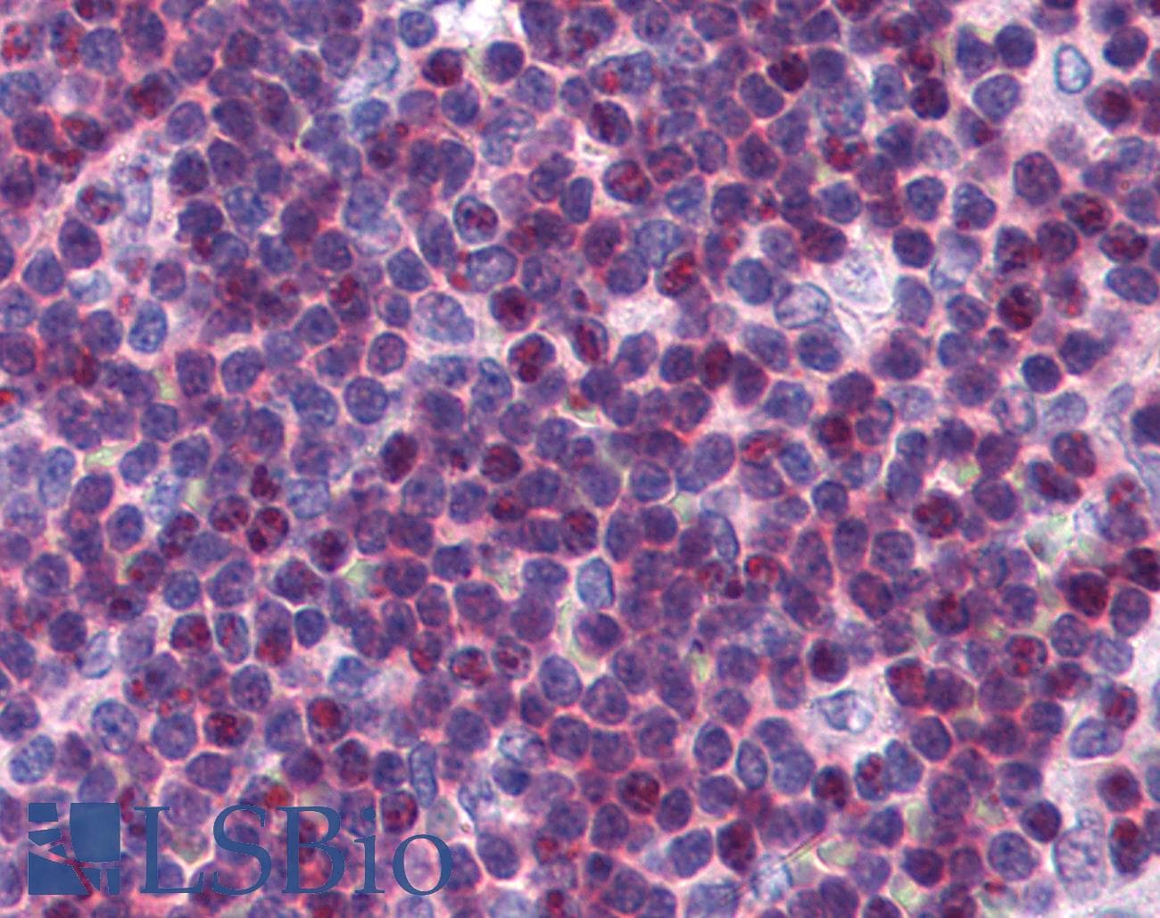 IHC-plus™ Polyclonal Goat anti-Human CDKN1B / p27 Kip1 Antibody (aa153-165, IHC, WB)