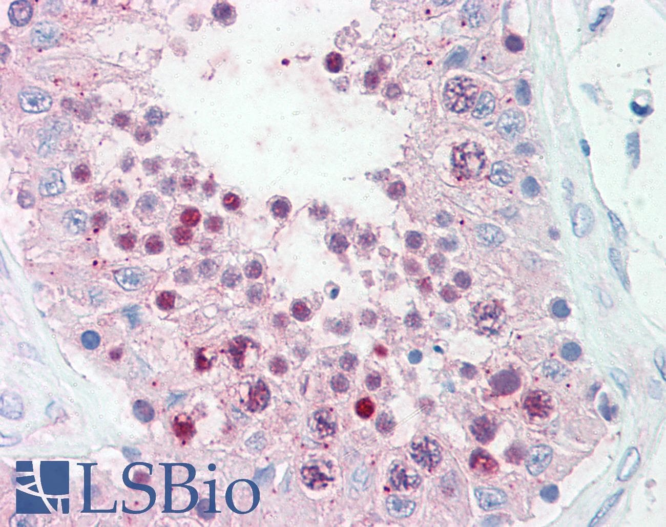 IHC-plus™ Polyclonal Rabbit anti-Human SLITRK6 Antibody (Cytoplasmic Domain, IHC)