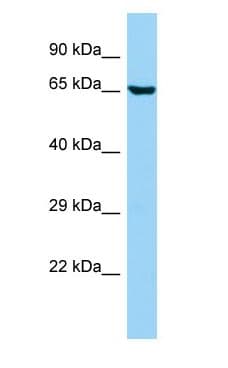 Polyclonal Rabbit anti-Human ANKS1B Antibody (C-Terminus, WB)