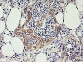PHF21B Antibody (clone OTI3D1)