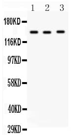 ACE / CD143 Antibody (aa702-715)