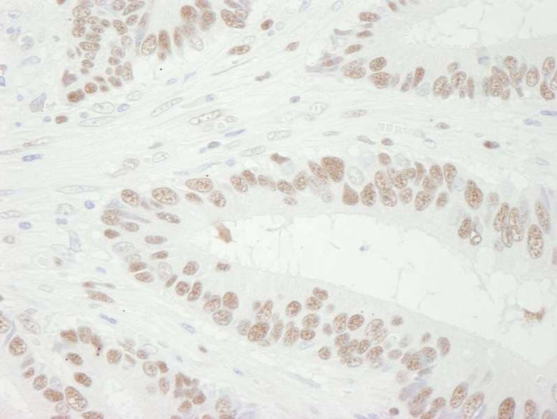 Polyclonal Goat anti-Human MCM3 Antibody (aa500-550, IHC)
