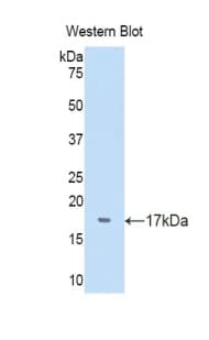 TTR / Transthyretin Antibody (aa20-147, FITC)