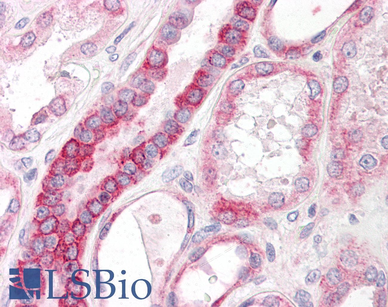 IHC-plus™ ST6GAL1 / CD75 Antibody (aa171-220)