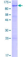 Human EME1 Protein (Recombinant GST)