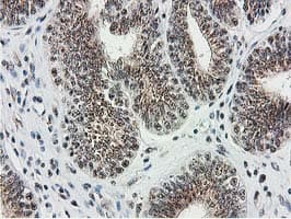 MGLL / Monoacylglycerol Lipase Antibody (clone OTI2B11)