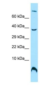 OST4 Antibody (C-Terminus)