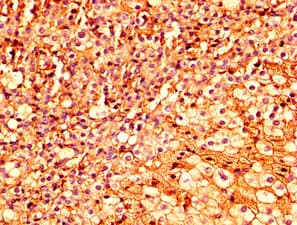 ESRP2 / RBM35B Antibody
