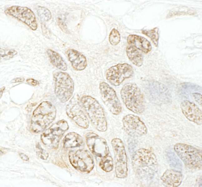 Polyclonal Rabbit anti-Human SETD1B / SET1B Antibody (aa350-400, IHC)