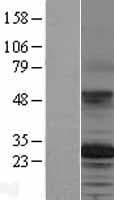 TSPAN12 Protein (Over-Expression Lysate Myc-DDK (Flag))