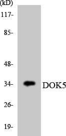DOK5 Antibody (aa80-129)