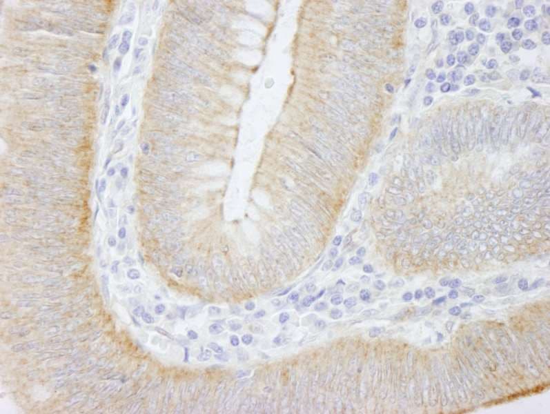 SPTAN1 / Alpha Fodrin Antibody (aa2422-2472)