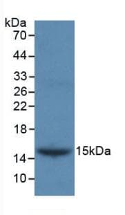 INHBB / Inhibin Beta B Antibody (aa277-391)