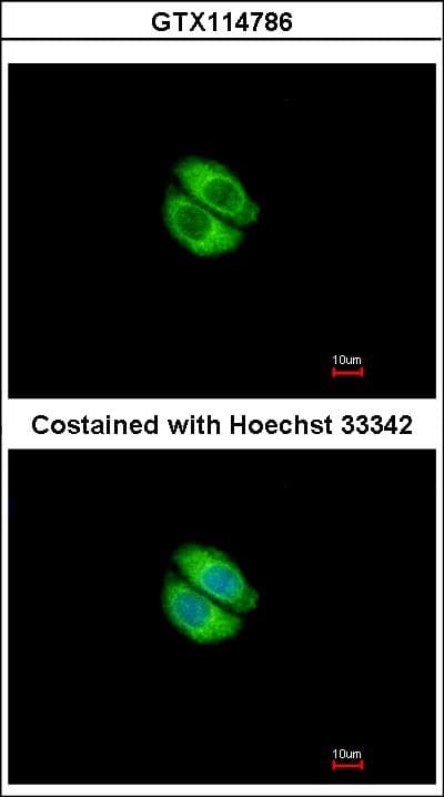 IHC-plus™ SNTA1 / Syntrophin Alpha 1 Antibody (aa191-505)