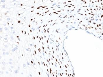 HPV16 L1 Antibody (clone HPV16L1/1058)