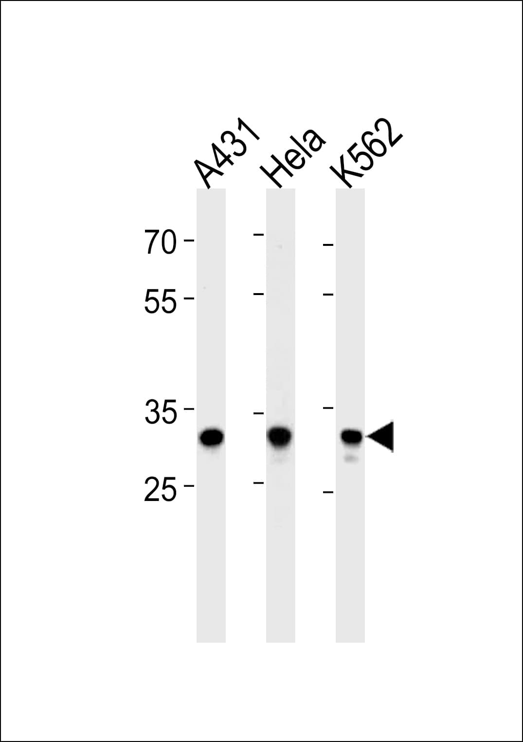 Polyclonal Rabbit anti-Human APBB3 Antibody (aa187-214, WB)