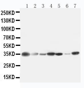 ARG1 / Arginase 1 Antibody (aa307-323)