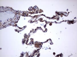 CD30 Antibody (clone OTI16H5)