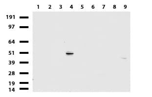 KRT20 / CK20 / Cytokeratin 20 Antibody (clone UMAB172)