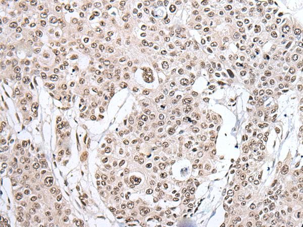 HNRNPH2 / hnRNP H2 Antibody