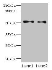 TUBB3 / Tubulin Beta 3 Antibody
