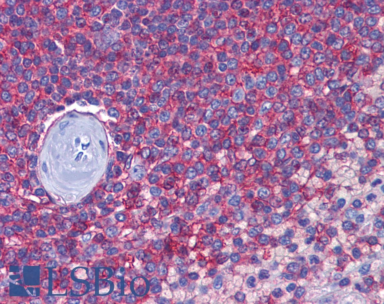 IHC-plus™ CD44 Antibody (clone 8E2F3)
