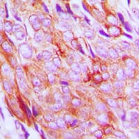 IGF1R / IGF1 Receptor Antibody (phospho-Tyr1161)