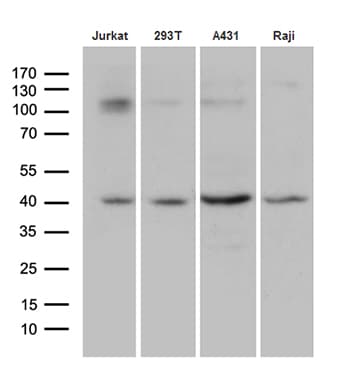 DNAJB5 Antibody (aa1-261, clone OTI6F11)