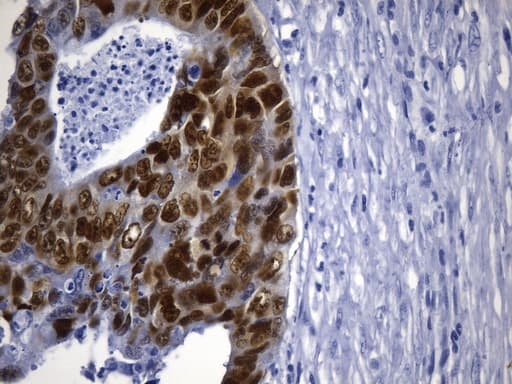 CDX2 Antibody (clone UMAB265)