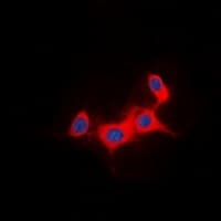 IRS1 Antibody (Internal)