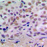 CREB1 / CREB Antibody (Internal)