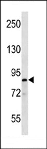 MARK1 / MARK Antibody (aa643-674)