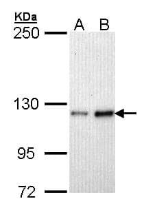 Polyclonal Rabbit anti-Human FBLN2 / Fibulin 2 Antibody (aa20-273, IHC, WB)