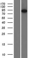 ESPN / Espin Protein (Over-Expression Lysate Myc-DDK (Flag))