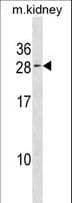 VPS25 Antibody (aa116-144)