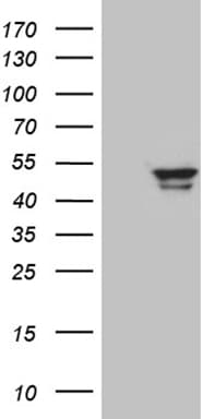 GCM1 Antibody (clone OTI1A4)