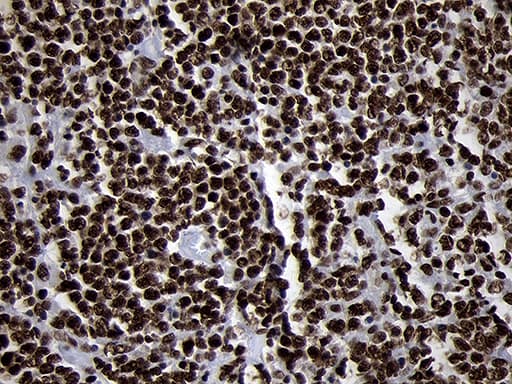 SMC1A / SMC1 Antibody (aa889-1016, clone OTI11E1)