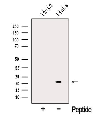NUDT16 Antibody