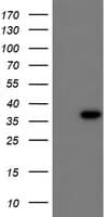 IHC-plus™ CBR3 Antibody (clone 1G6)