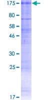 Human CLCN1 / CLC-1 Protein (Recombinant GST)