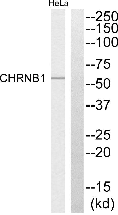 CHRNB1 Antibody