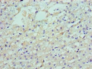 Polyclonal Rabbit anti-Human ARH / LDLRAP1 Antibody (aa59-308, IHC, WB)