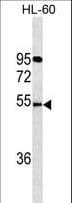 FKRP Antibody (aa418-444)
