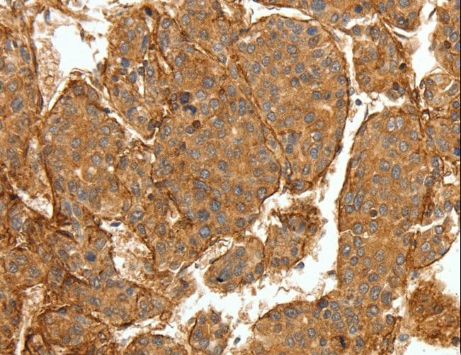 COL4A1 / Collagen IV Alpha1 Antibody